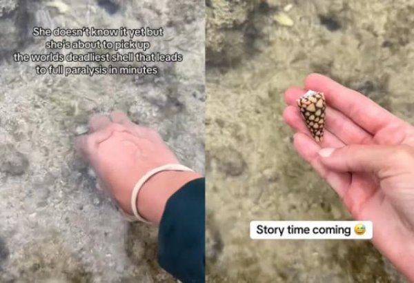 股E融 女子在冲绳海边捡到漂亮贝壳，竟是“最毒杀手”，严重恐致命
